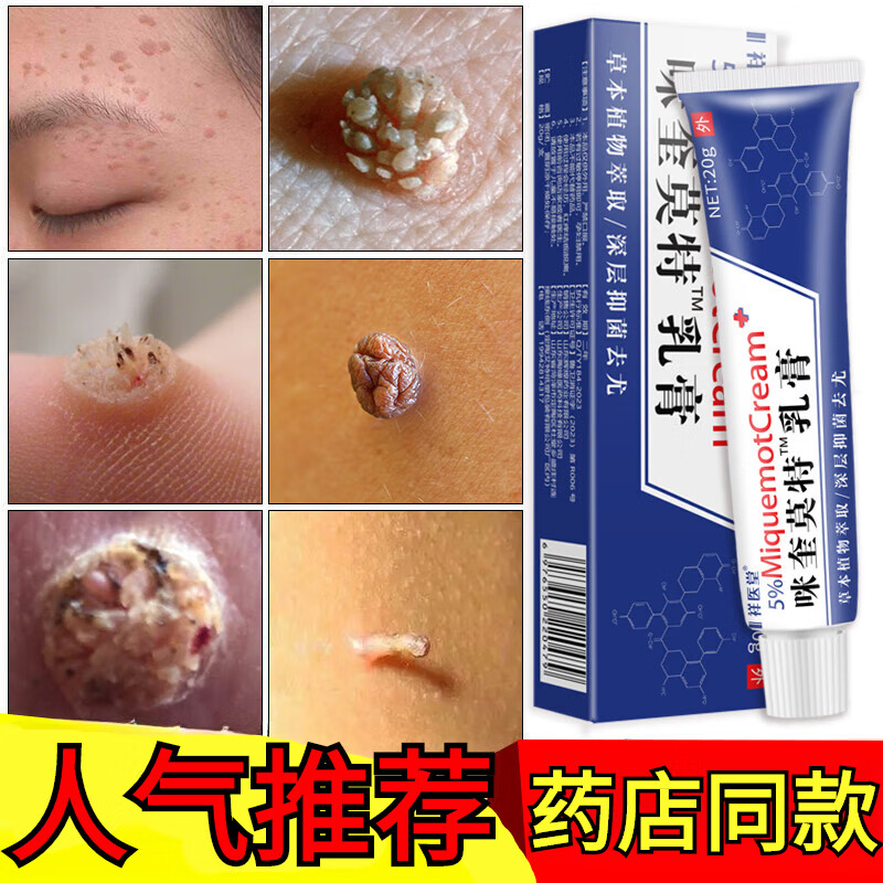 丝状疣尖锐湿疣疣灵肉粒非药品男性跖疣瘊灵去除脖子小肉粒疣体脱 疣