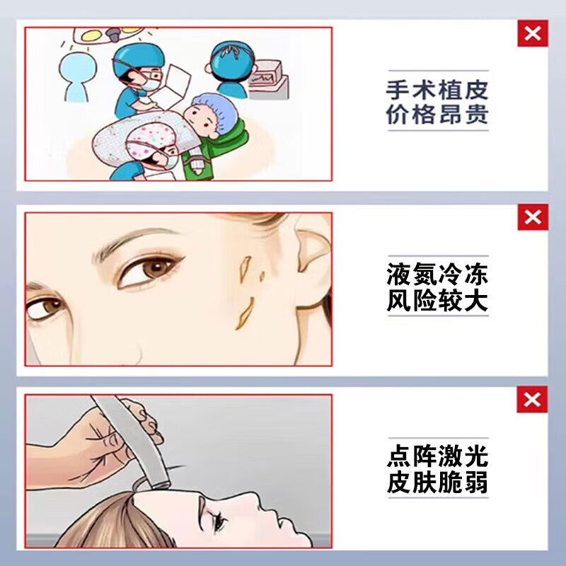 葵花 防增生疤痕贴疤痕增生凸起去除疙瘩止痒烫伤去疤恢复贴缝针术后 三盒【买2送1】疤痕修复凝胶