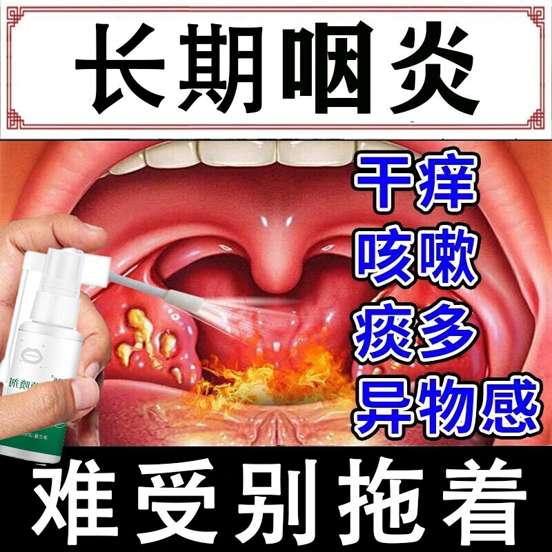 咽炎慢性咽炎除i根滤泡增生喷雾剂喉咙有痰异物感咽喉肿痛干咳 一盒装