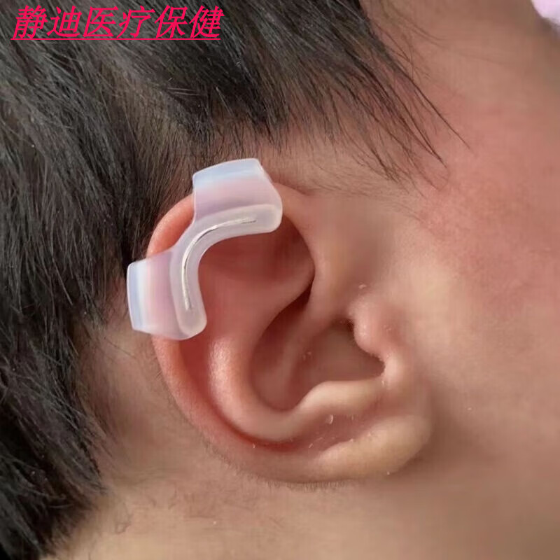 耳朵矫正器ukepoe婴儿耳朵矫形器内置小儿矫正贴耳廓矫正贴纠正塑 b款