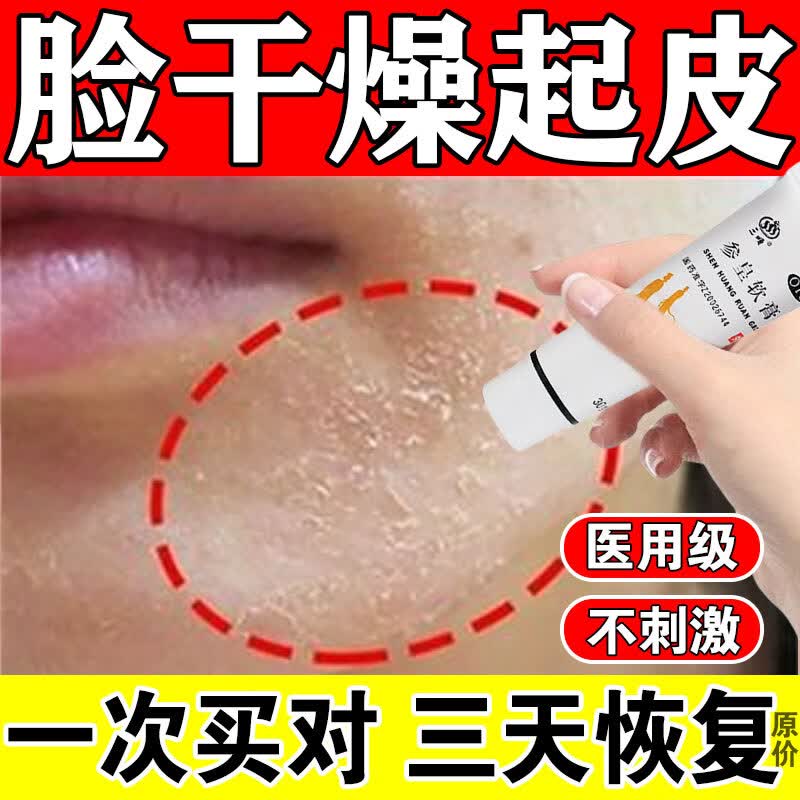 四季皮肤干燥脱皮有碎屑过敏红痒油腻消炎止痒专用药养血润燥参皇软膏