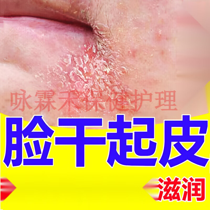 昊达 尿素维e护肤霜每支50g脸皮肤干燥起皮脸上起干皮爆皮有碎屑起癣