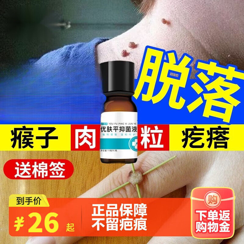 疣瘊灵去除脖子小肉粒一抹忧无脖子上小肉球肉刺疙瘩赘肉丝状疣瘊子