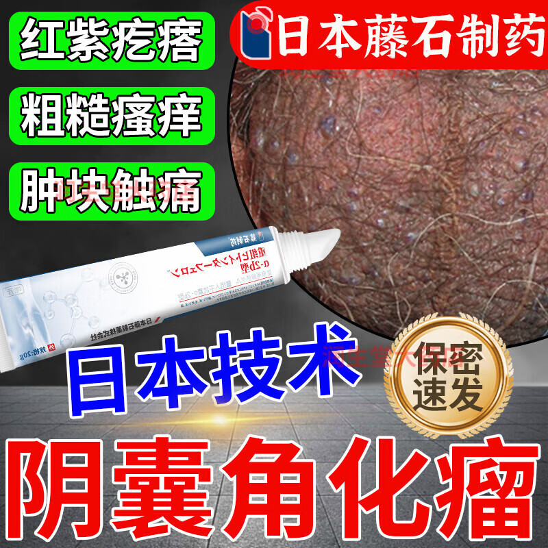 京都念慈菴阴囊血管角化瘤血管痣蜘蛛痣睾丸红斑潮湿丘疹表皮瘙痒粗糙