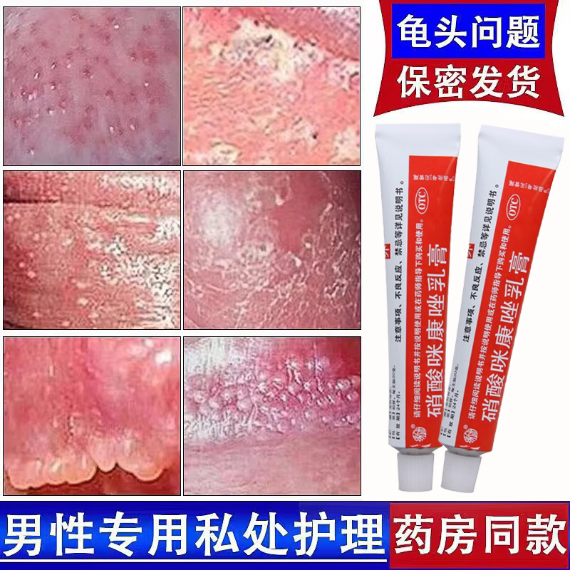 龟头炎症专用药 治疗念珠菌性龟头炎的药 软膏男性私处龟头炎止痒杀菌