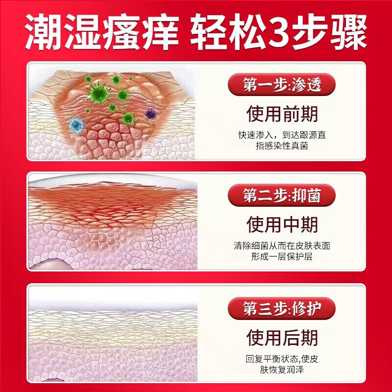 纾大夫阴囊炎阴囊潮湿瘙痒脱皮睾丸瘙痒肛门大腿内侧蛋蛋湿疹抑菌止痒膏 双重功效组合装(轻度)