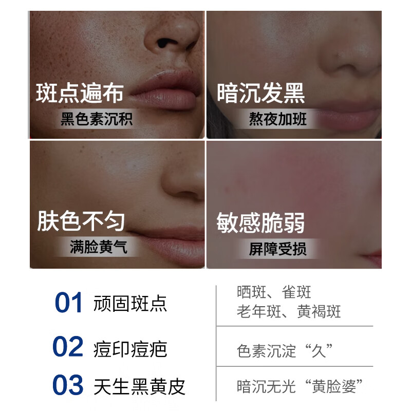 斯诺舟法国品牌医用级烟酰胺凝胶5%浓度30g美白淡斑祛黑色素去老年斑 【法国院线同款】1支装体验装