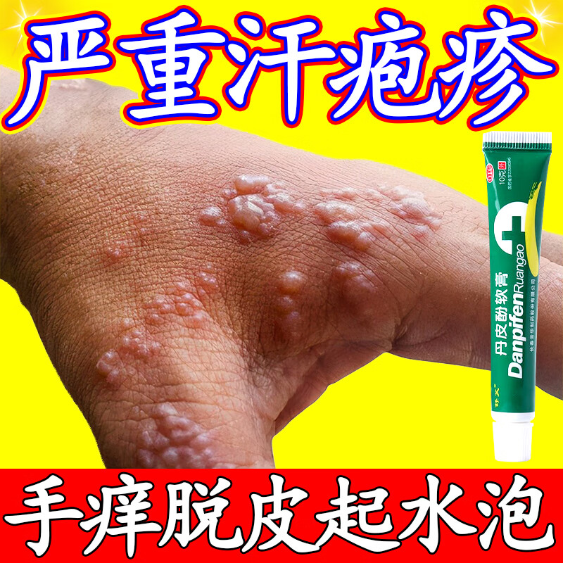丹皮酚软膏 1盒装【手上起小水泡手指真菌感染】汗疱疹抑菌药膏