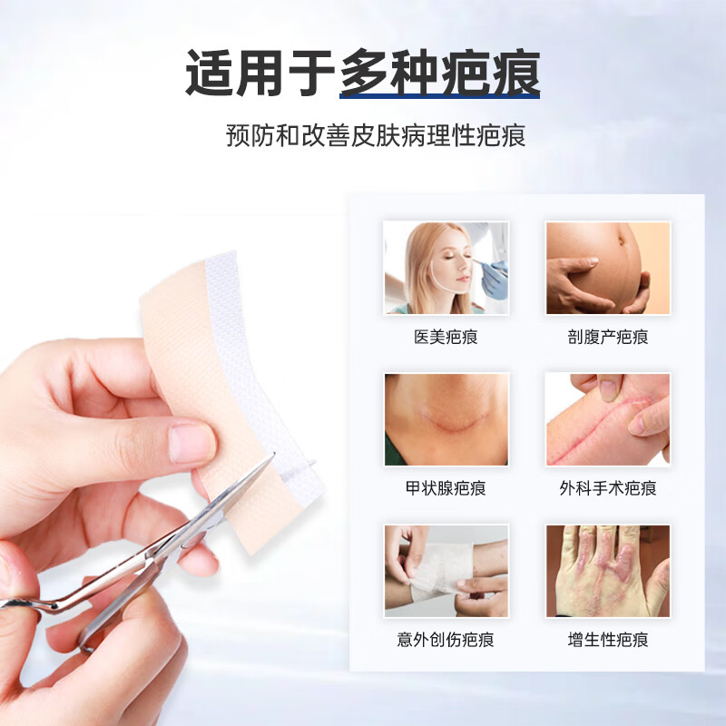 奥嘉莱(O’garlos)德国进口原料医用硅酮凝胶疤痕贴甲状腺剖腹产术后祛增生疤痕敷料 【剖腹产推荐】奥嘉莱 4*30 1盒