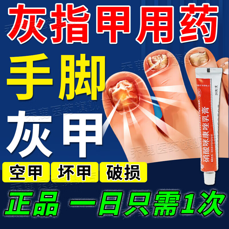 治灰指甲的药膏 甲癣真菌感染指甲特厚发黄分层治灰指甲空甲脱甲增厚