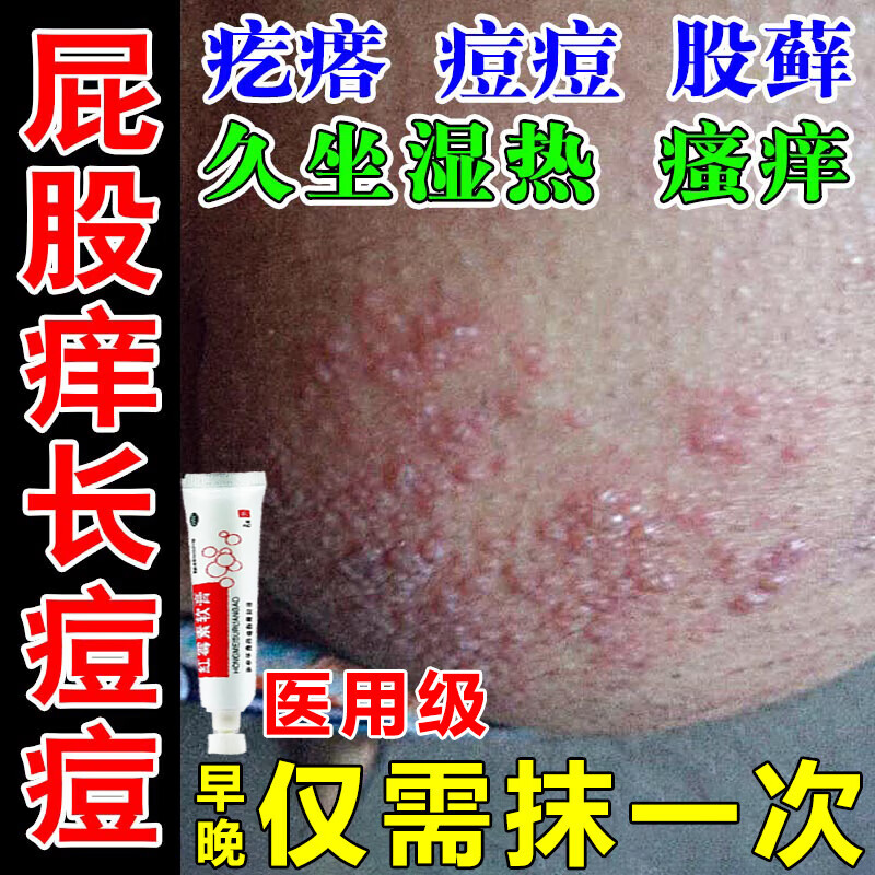 坐板疮专用药膏 屁股上长坐板疮 红霉素软膏治屁股瘙痒久坐长痘痘坐板