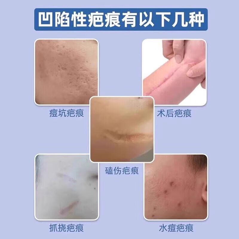 修正医用细胞重组三型人源化胶原蛋白凝胶创面修复促进愈合皮肤屏障 单盒【体验装】