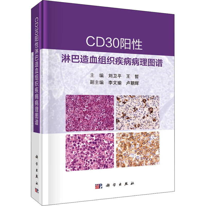 CD30阳性淋巴造血组织疾病病理图谱 刘卫平,王哲 编 书籍