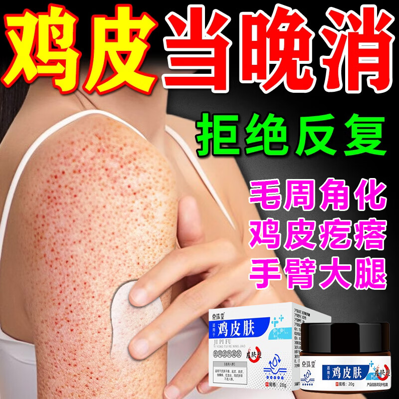 鸡皮肤疙瘩毛囊角化症专用葯药儿童成人鸡皮肤去除神器毛囊角质疙瘩