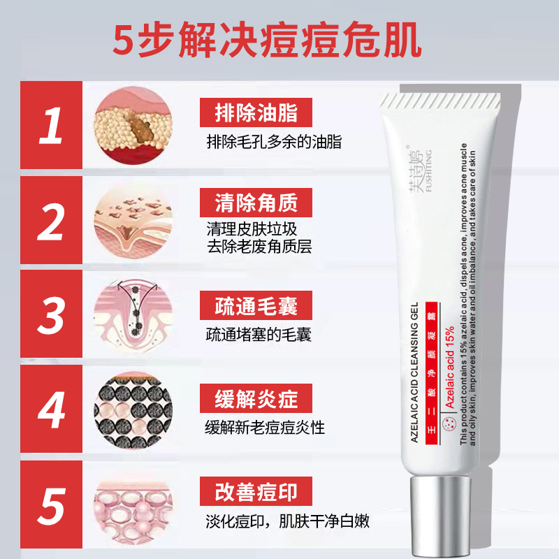 芙诗婷壬二酸15%凝胶乳膏祛痘淡化痘印清洁黑头闭口粉刺油痘肌凝露软膏 3支【15%壬二酸】周期装