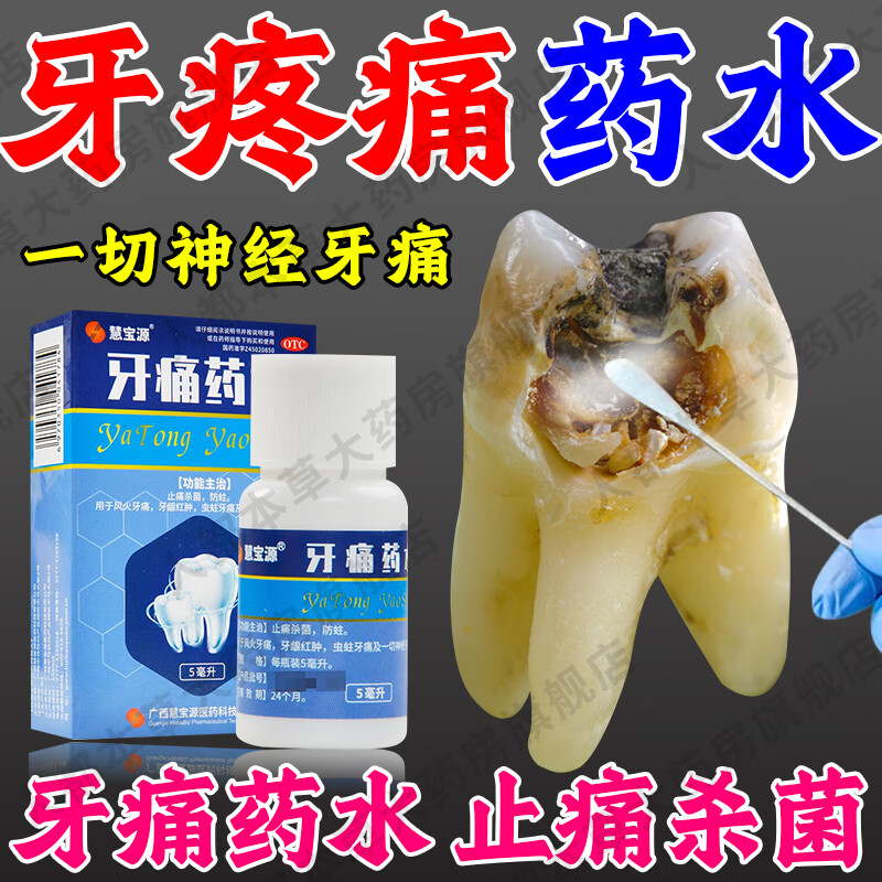 牙疼专用药】牙痛药快速止痛治疗一切神经牙痛牙龈肿痛儿童成人烂牙坏