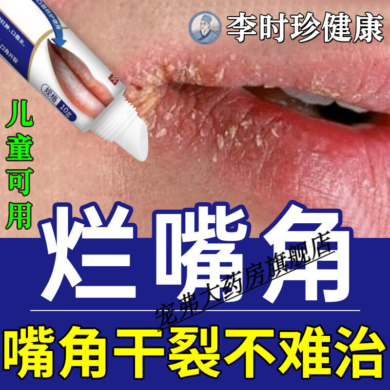 治唇炎的唇膏(治唇炎的药膏十大排行)