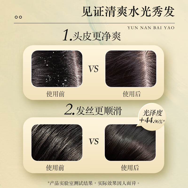 养元青去屑洗发水柔顺去油止痒丝滑洗发露改善毛躁头皮护理洗发 【尝鲜装】去屑柔顺洗发水210ml