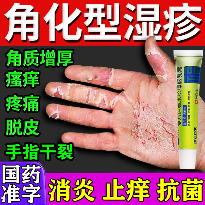 角化型湿疹药】手指皲裂性湿疹药膏去皮炎湿疹专用药手脱皮瘙痒干裂