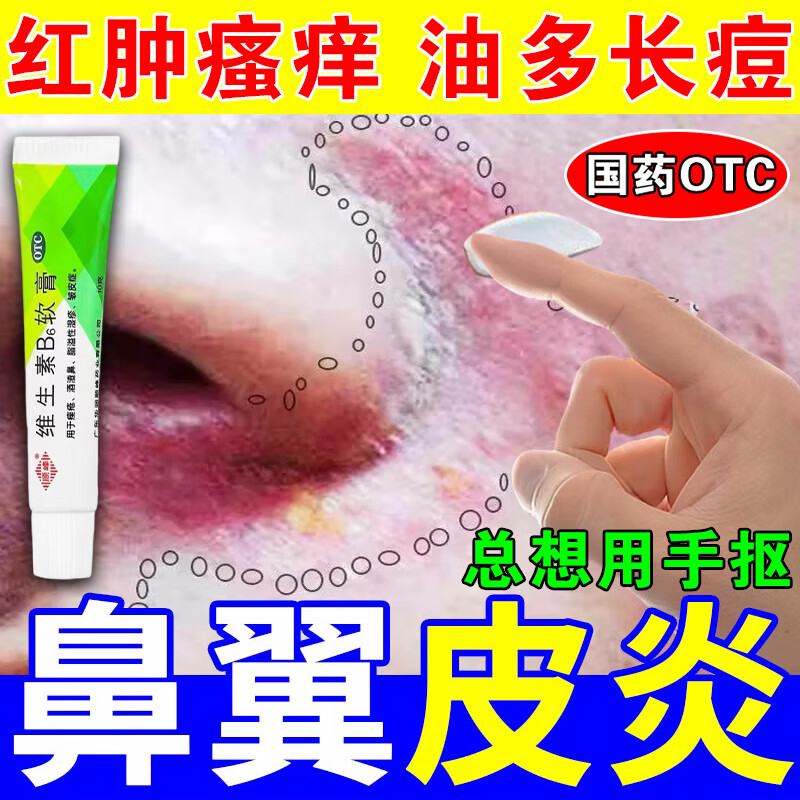 鼻翼溢脂性皮炎 脂溢性皮炎专用药面部脸鼻子周围红肿发痒 鼻翼两侧