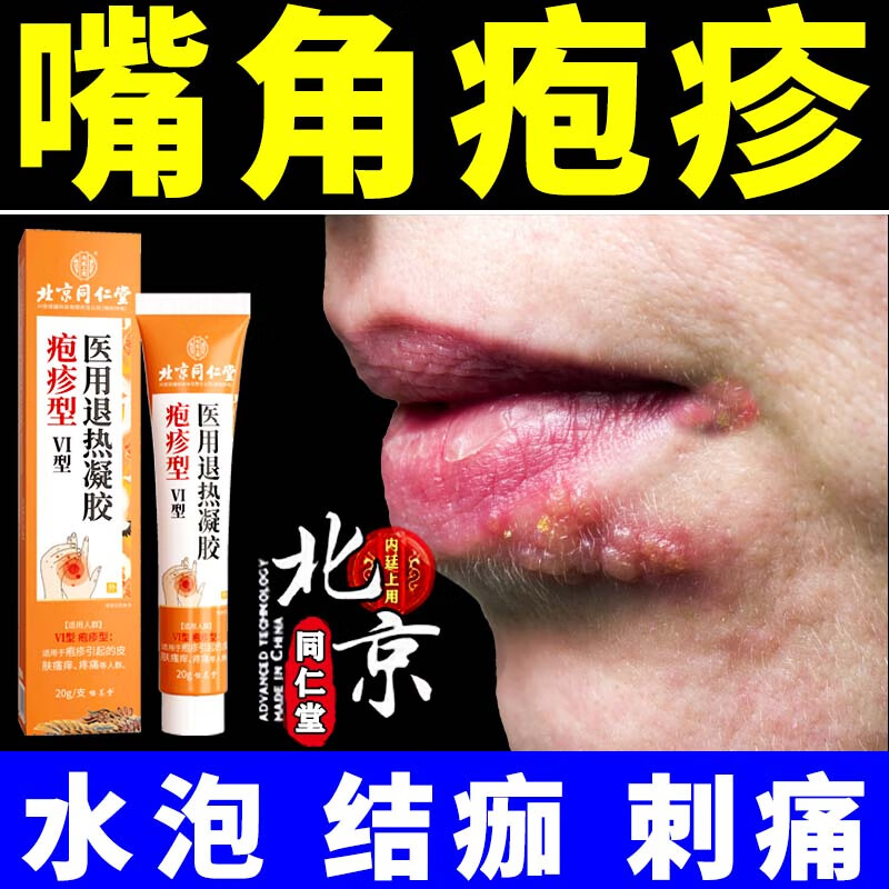 北京同仁堂 嘴唇疱疹 嘴上起水泡 嘴唇嘴巴烂嘴角 结黄痂瘙痒刺痛