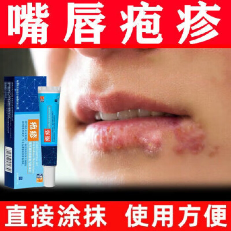 御药名家嘴唇起泡烂嘴角嘴巴上火起水泡嘴巴脓疮口角肿发痒溃烂上火