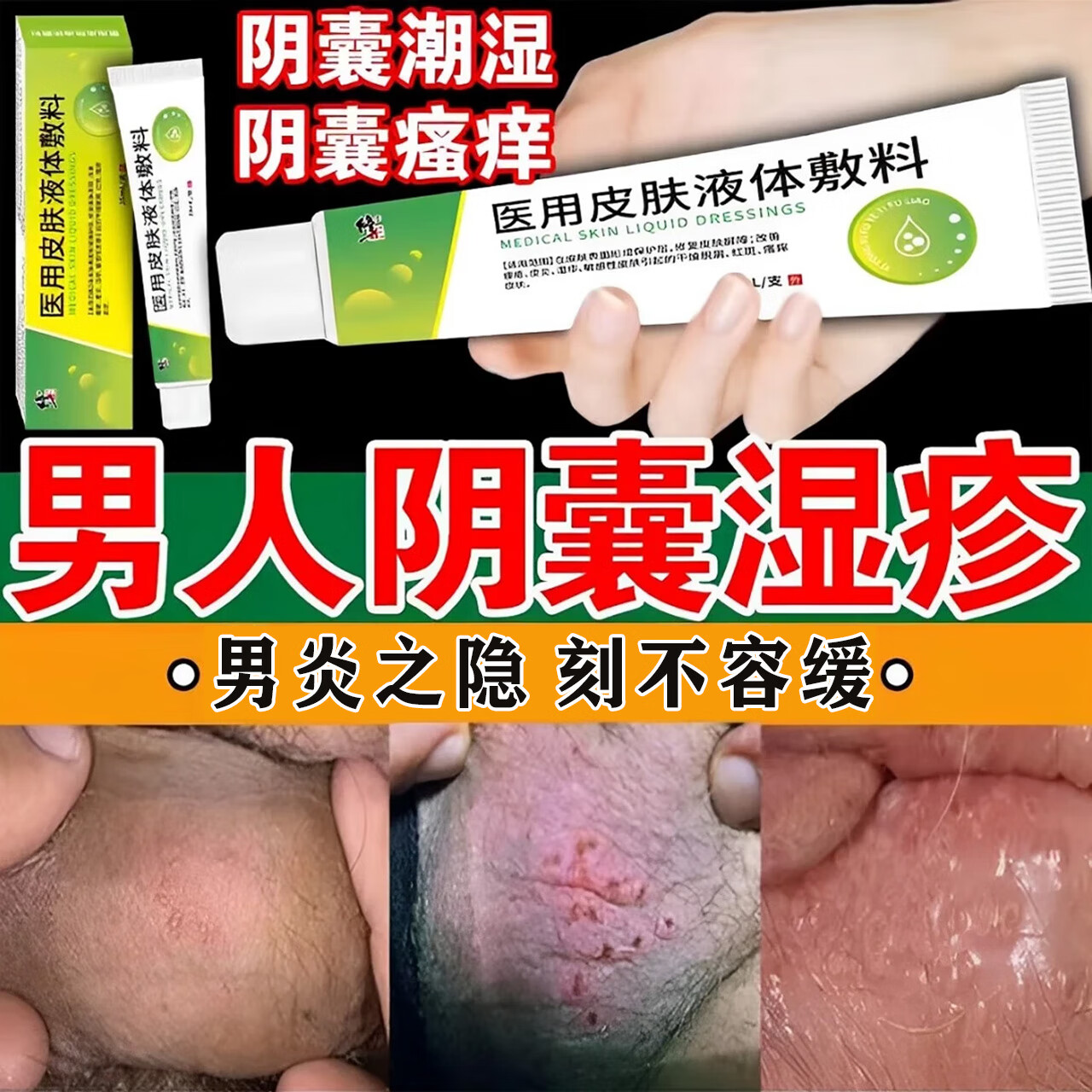 君吻阴囊潮湿瘙痒男人专止痒去阴囊湿疹用私处睾丸去潮湿大腿根部内侧