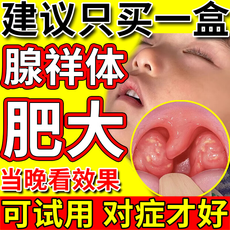 修益舒儿童腺样体肥大贴面容矫正i器儿童防张嘴呼吸睡觉扁桃体肿大贴