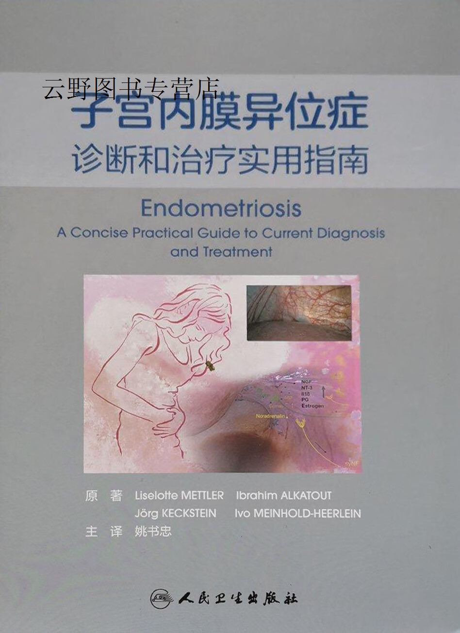子宫内膜异位症诊断和治疗实用指南,(德)莉泽洛特·梅特勒(liselotte