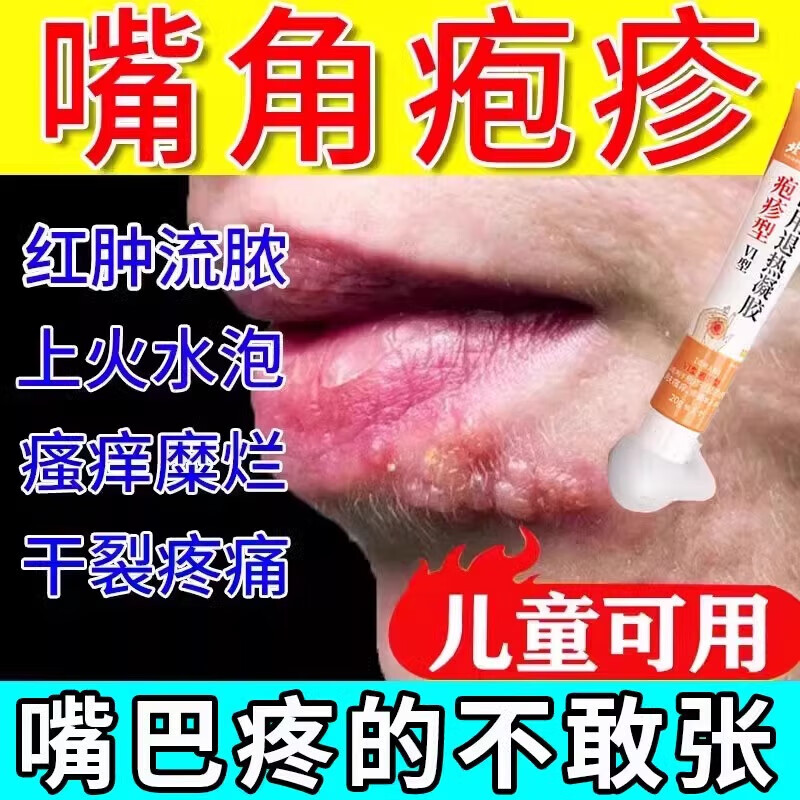 嘴角疱疹上火嘴巴烂皮炎口唇疱疹嘴唇疱疹起泡烂嘴角起水泡嘴巴脓疮