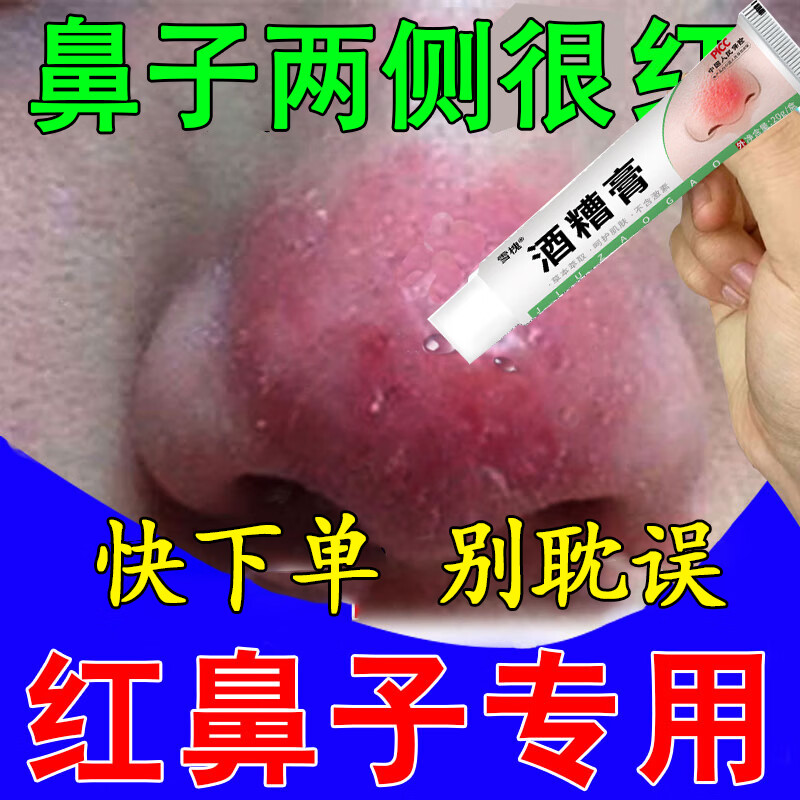 酒糟鼻红鼻子红血丝糟糠皮肤酒渣鼻螨虫粉刺黑头皮肤抑菌凝胶官方正品