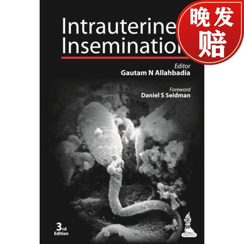 【4周达】intrauterine insemination