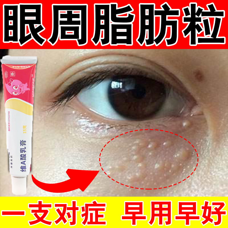 维a酸乳膏 扁平疣药膏 去猴子扁 角化异常专用药去猴子药膏 肉刺药膏