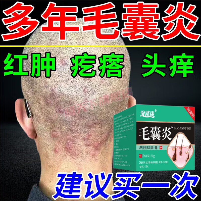 贝因维丝(beiyvs)北阿米毛净康官方抑菌膏毛囊炎宫头部头皮上脸上后脑