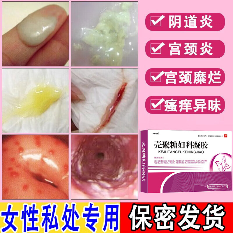 妇科凝胶私处妇科炎症霉菌性阴道炎用药瘙痒专科女性外阴部瘙痒专用
