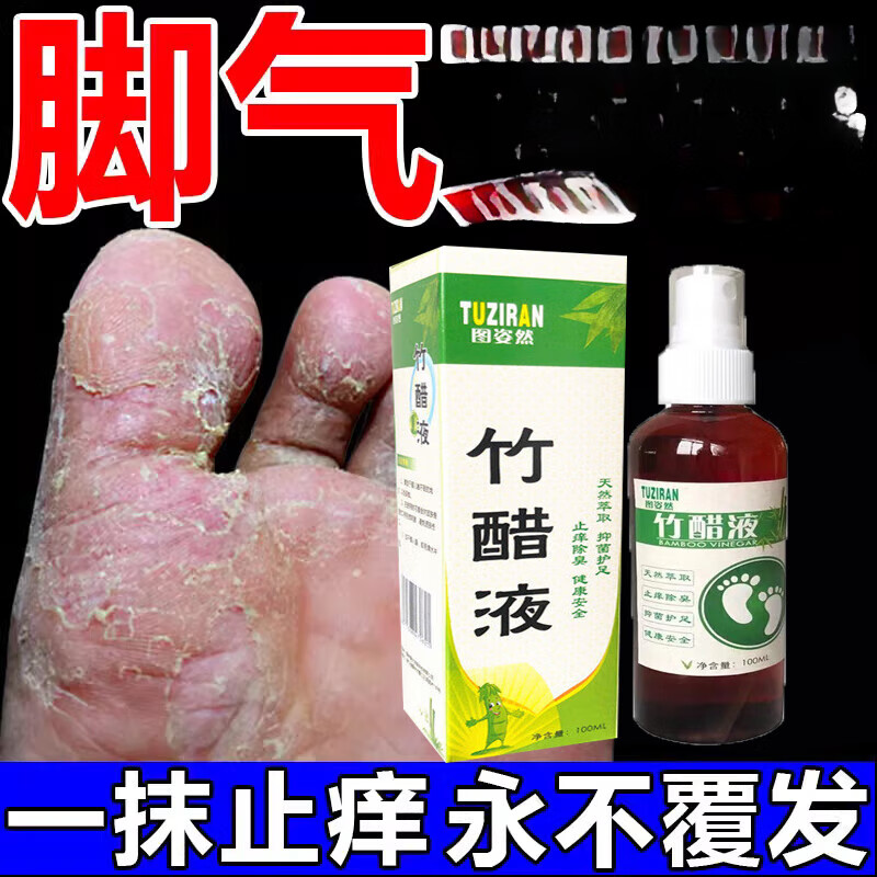 胭脂后脚气白醋足竹醋液香港脚气水脚气神油克星止痒真菌感染水泡臭 1