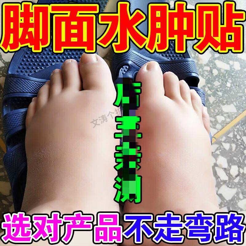 水肿贴老人脚肿穿不上鞋腿脚浮肿下肢水肿浮肿贴内分一盒 买2贈1