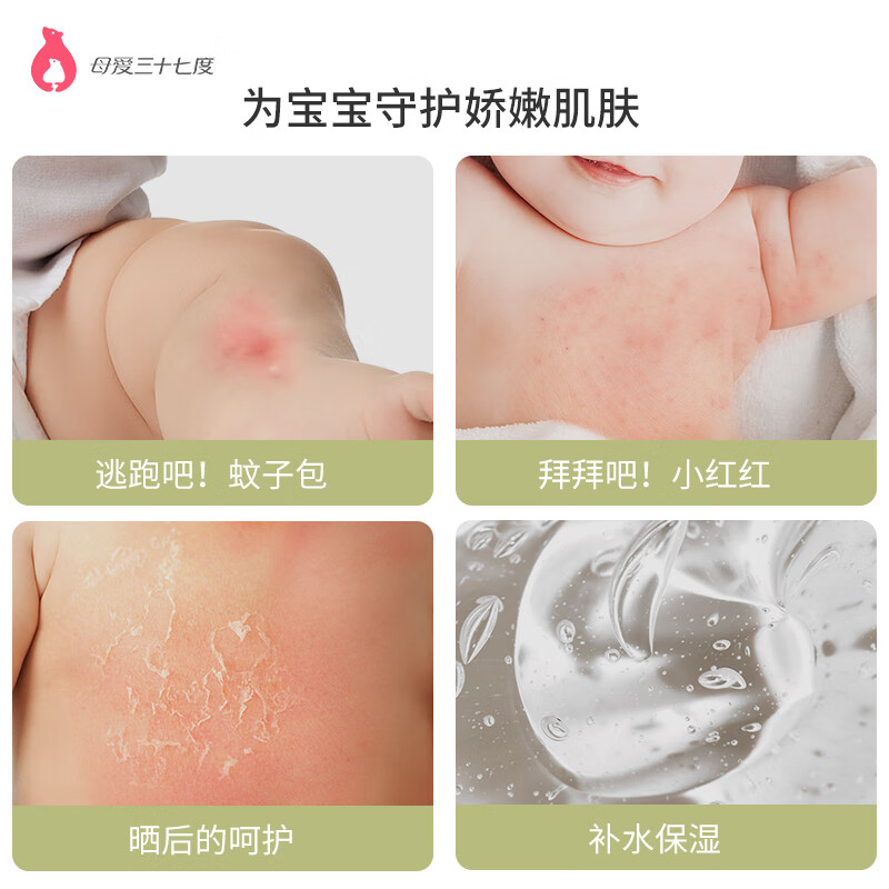 母爱三十七度木糖醇爽肤凝露婴幼儿保湿舒缓啫喱宝宝润肤乳蚊子包四季