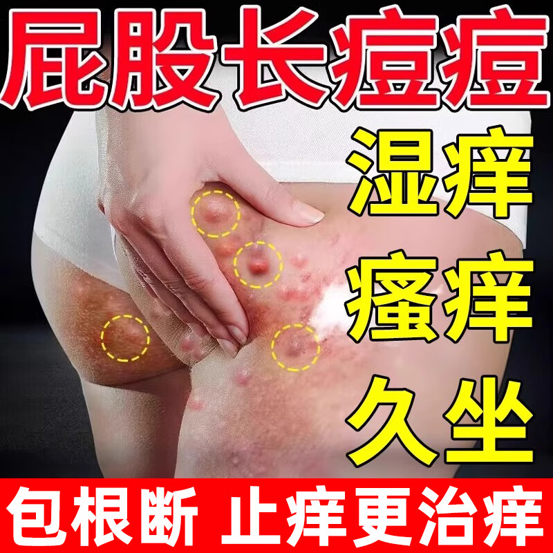拜耳(bayer)拜耳bayer屁股瘙痒久坐长痘痘坐板疮硬块