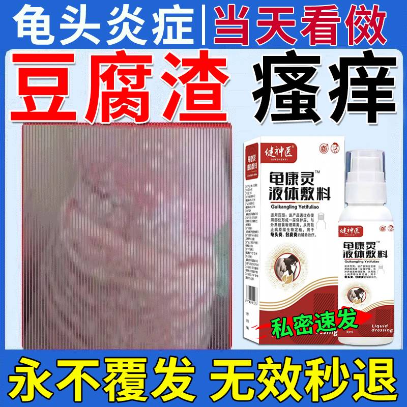 龟头炎包皮炎专用的药真菌感染特傚效药霉菌性珍珠疹糜烂私处白垢豆腐