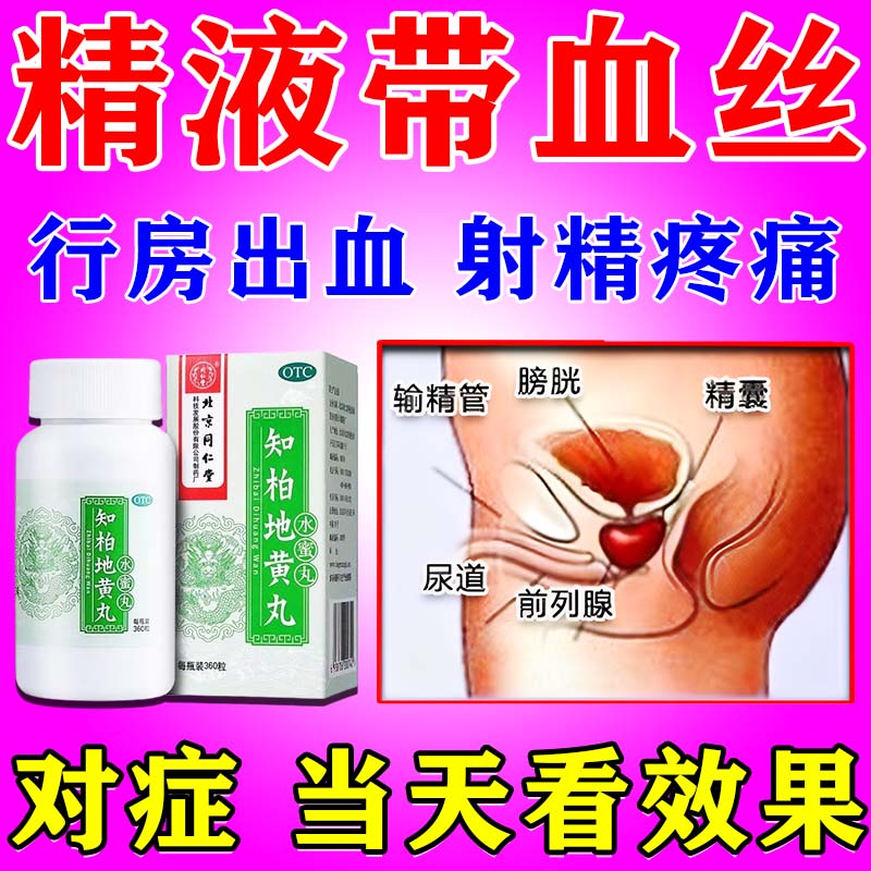 精囊炎特药前列腺炎血精症消炎专用药治疗效附睾炎睾丸疼痛黄精血精