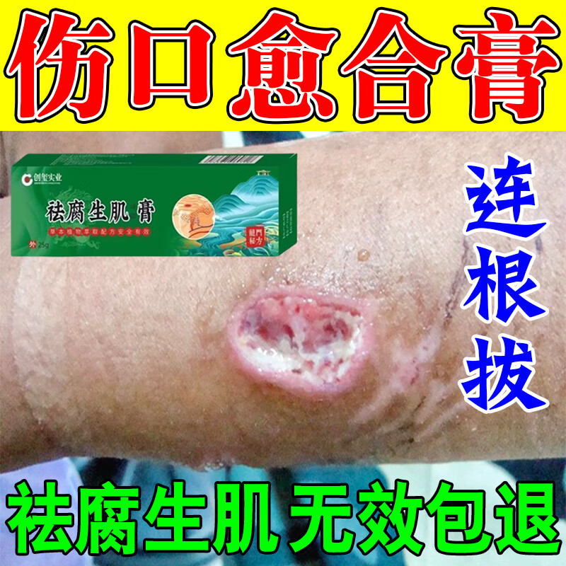 褥疮膏老人臀部外用橡皮腐去生肌膏 伤口愈合同仁仁堂生肌膏长肉愈合