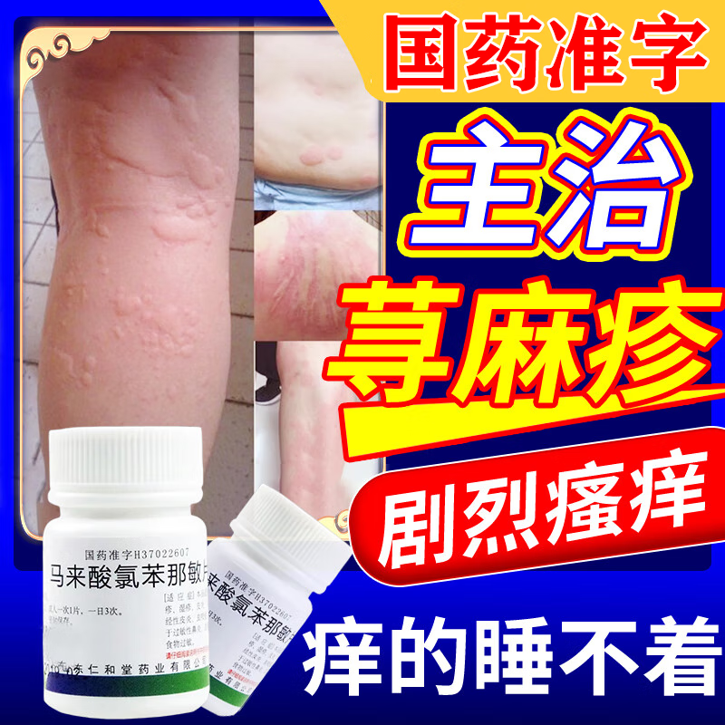 过敏止痒药 3盒【马来酸氯苯那敏片】荨麻疹用什么药