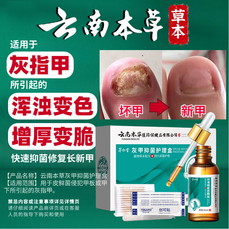 茅仁堂云南本草灰指甲抑菌液特殊效中草药去坏甲长新甲30ml