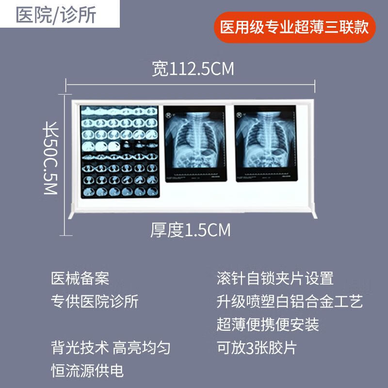 超薄x光观片灯箱医用led看片灯箱阅片灯三联看观片灯双联骨科核磁