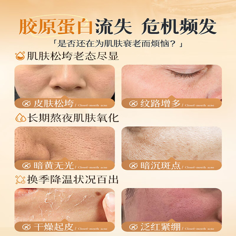 润凰377美白祛斑vc精华液抗皱紧致精华抗衰老毛孔收缩烟酰胺提亮淡斑 5瓶【逆袭冷白皮】