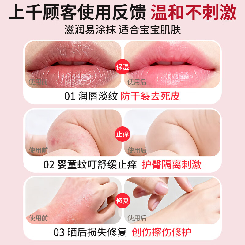 KoalaMan考拉侠澳洲番木瓜膏25g润唇膏护唇膏宝宝护臀保湿淡化唇纹防干裂 【爆款超值推荐】番木瓜膏25g*2支