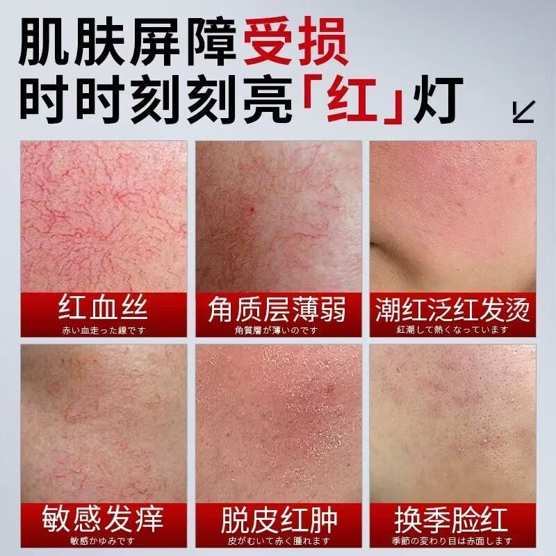 示博士祛红血丝精华液高原红激素脸修复敏感肌鼻子红血丝男女通用 5盒推荐装【改善重度泛红】
