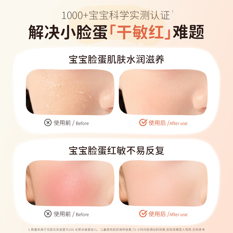 花肌氏儿童面霜保湿乳滋润舒缓春夏换季防皴宝宝婴儿乳液青少年面霜 【一瓶装】舒缓面霜50g