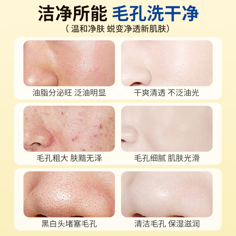 QISE硫磺洗面奶净颜洁面乳深层洁净滋润保湿清洁毛孔清爽温和不刺激 硫磺洁面乳*3支,